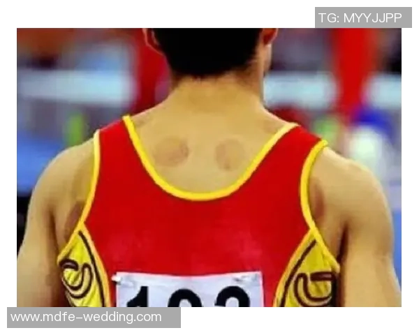 足球球星拔火罐背后的秘密 揭开运动员恢复与健康的独特方法